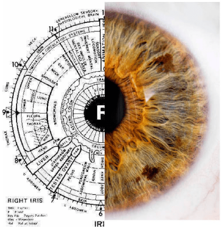 Iridology, Bernard Jensen, disease signs of the eye, genetic, predisposition,